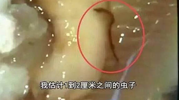 一只生蠔引起的冤案，觸動(dòng)了餐飲人的“麻木神經(jīng)”